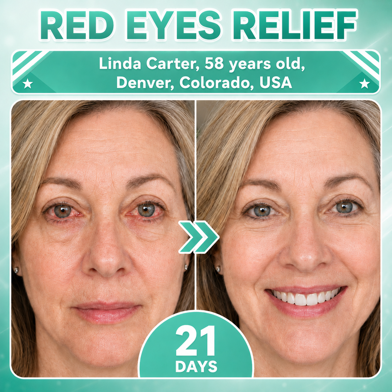 Red-eye comfort supplier visual