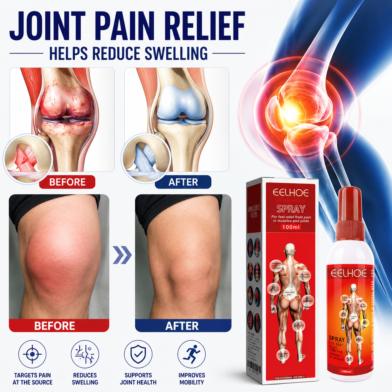 EELHOE™ Rapid Comfort Spray – Targeted Muscle & Joint Support Formula-WH