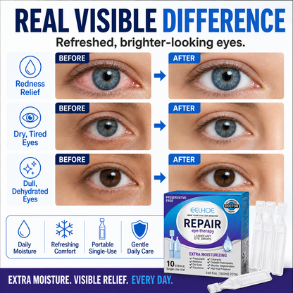 Daily Moisturizing Eye Drops | Refreshing Comfort for Dry, Tired-Feeling Eyes-YH