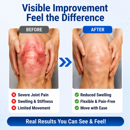 NAD+ Advanced Joint Relief Cream | Advanced Topical Formula for Joint Comfort & Flexible Movement-WH