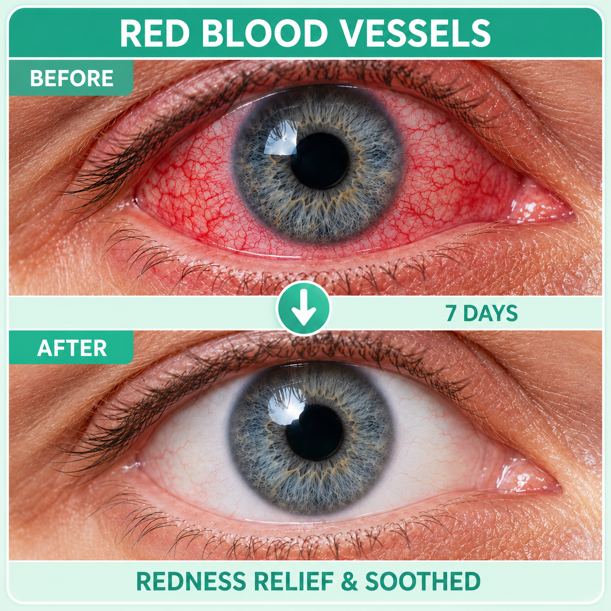 Red blood vessels before and after comparison